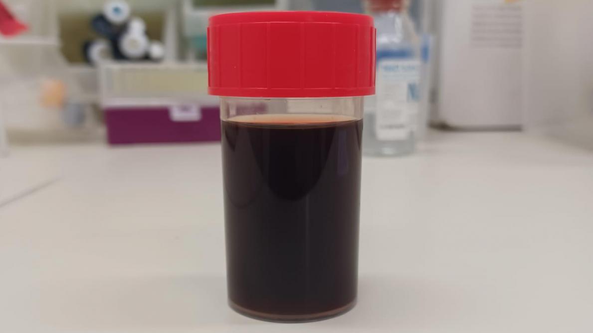Donkerbruin verkleurde urine, ten gevolge van de methemoglobinevorming door het koper dat in het bloed aanwezig is.