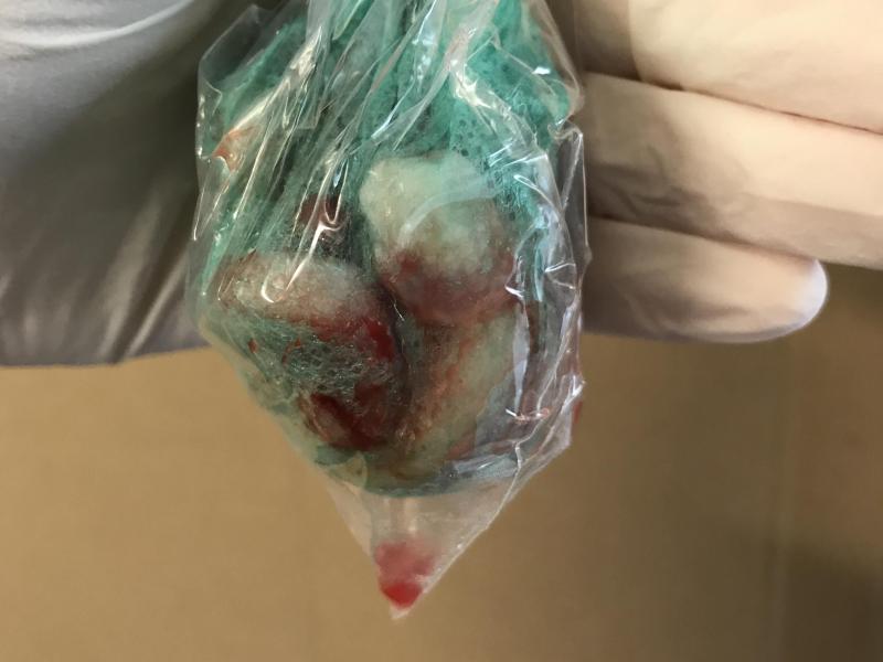 Stop alle weefsels in een zakje om zo het weefselvocht te kunnen verzamelen.