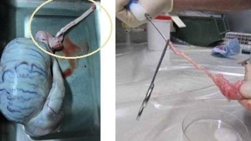 De linkse foto toont een testikel met de bijbal. De staart van de bijbal en de zaadleider zijn omcirkeld. De rechtse foto toont de retrograde flush van deze structuren.
