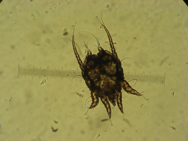 Een schurftmijt, Psoroptes ovis, onder de microscoop.