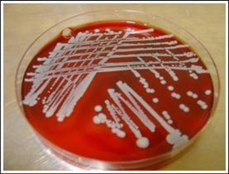 Geënte bloedplaat met bacteriegroei.